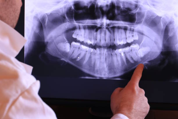 Best Emergency Gum Pain Relief  in Batesville, TX